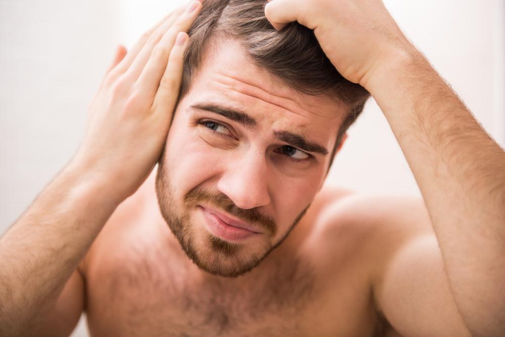 Natural remedies for baldness that you should try