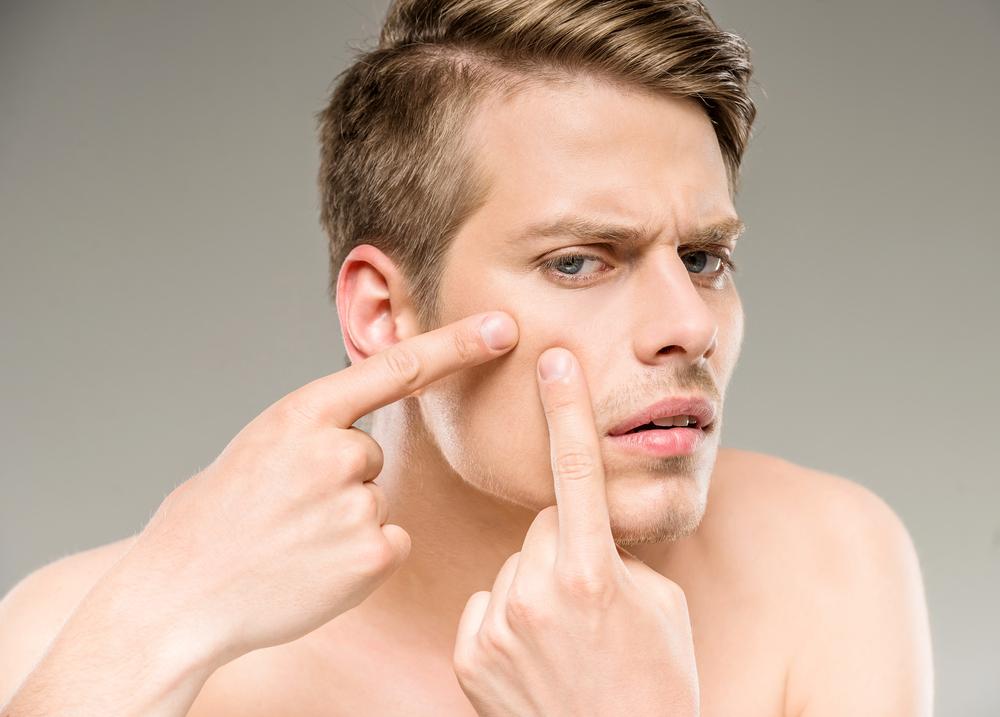 Getting rid of acne scars with laser