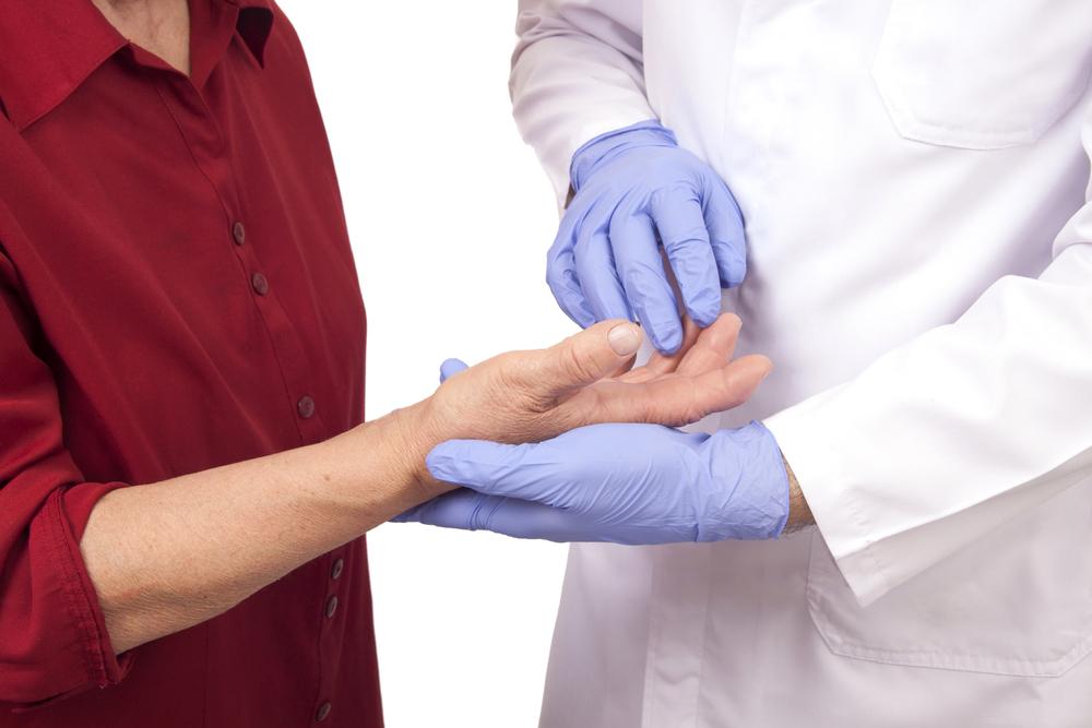 Treatment Options for Rheumatoid Arthritis
