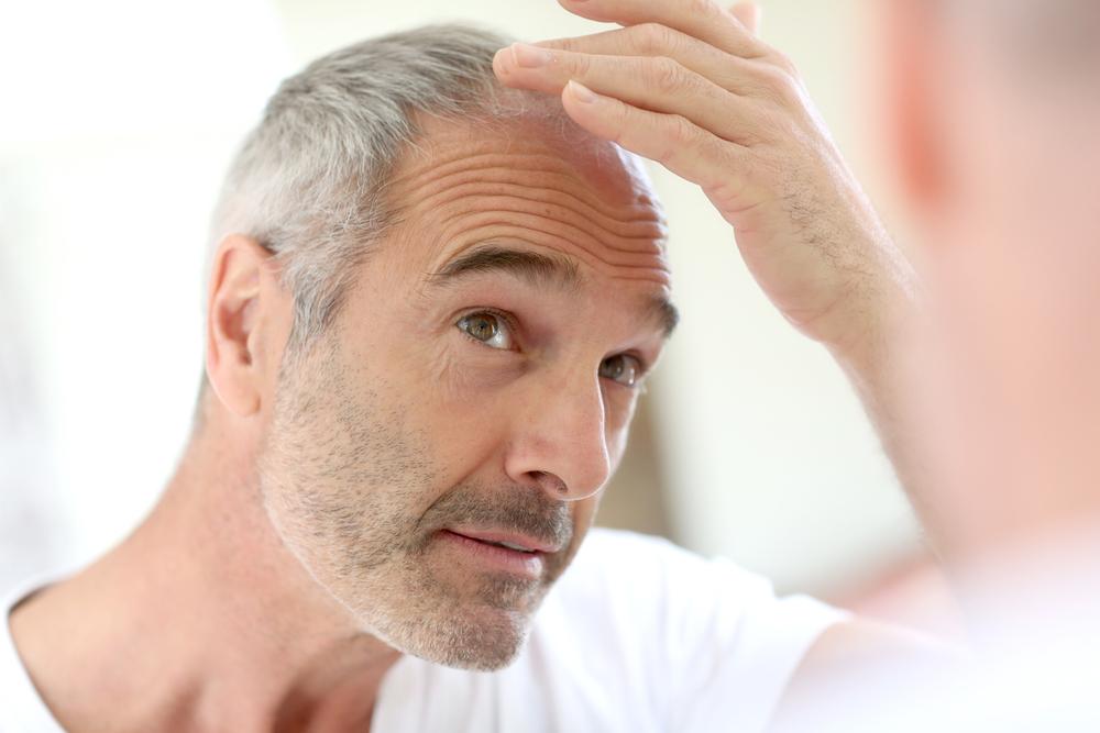 Signs and Prevention of Hair Loss