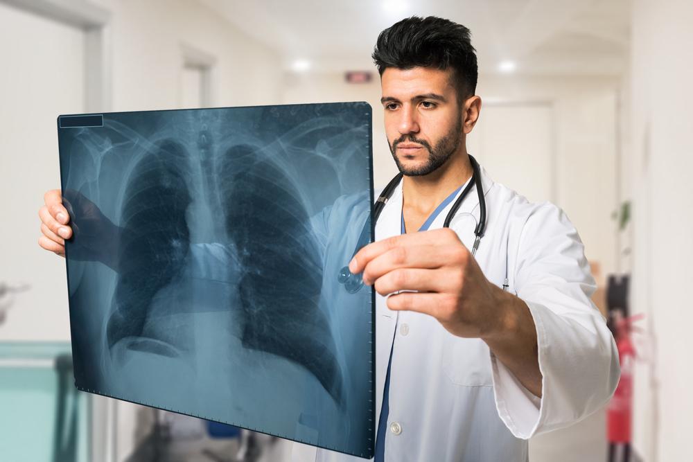 Symptoms of Non Small Cell Lung Cancer